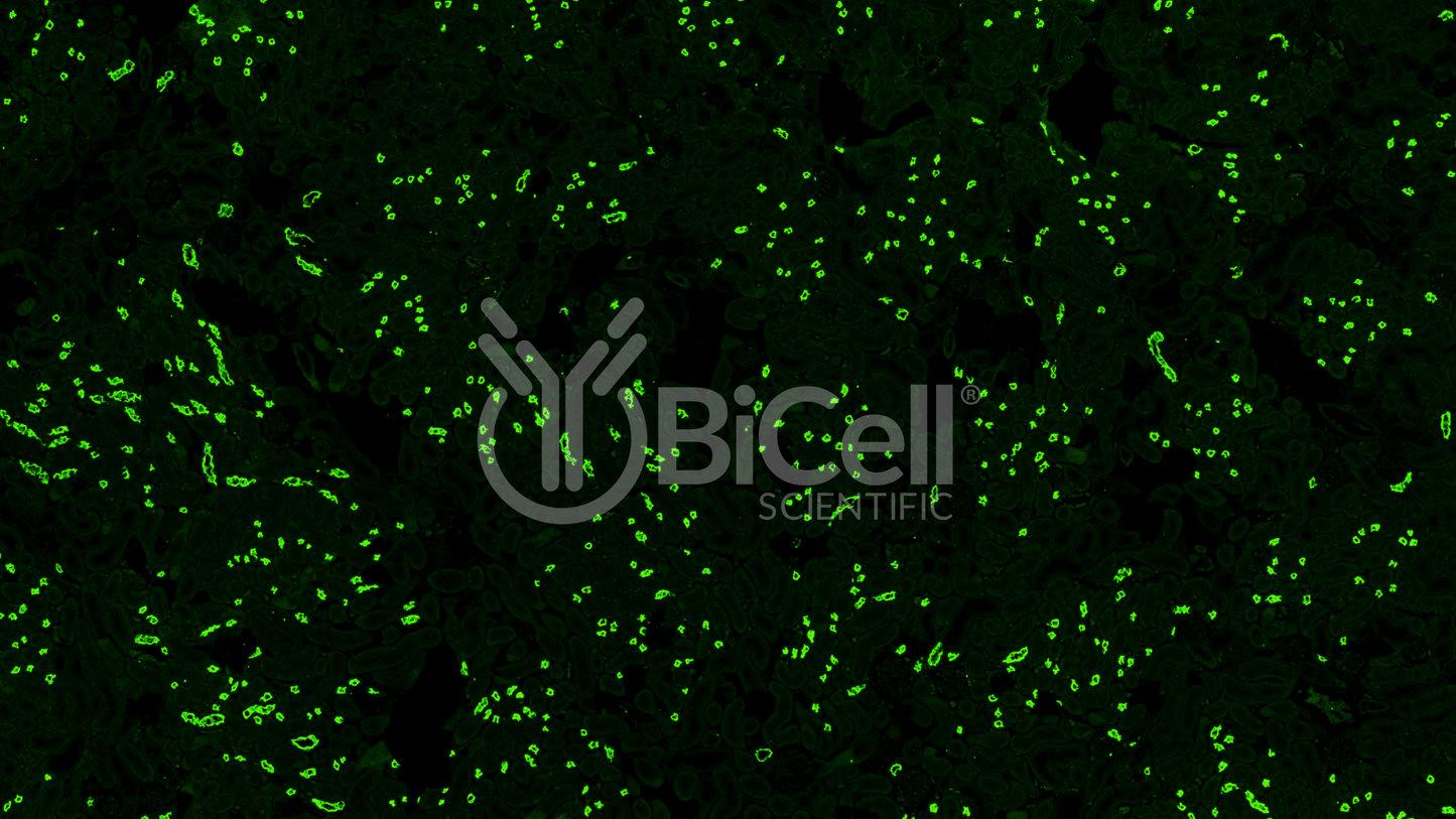 NKCC2 (Slc12a1) Antibody - Western Blot Validated