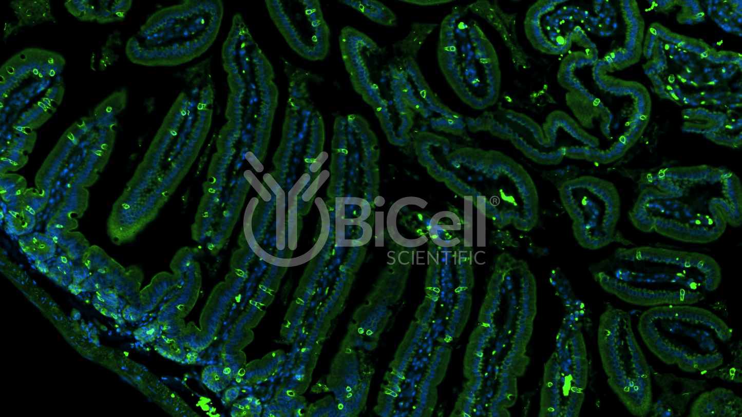 CCR3 (CD193) Antibody - Western Blot Validated