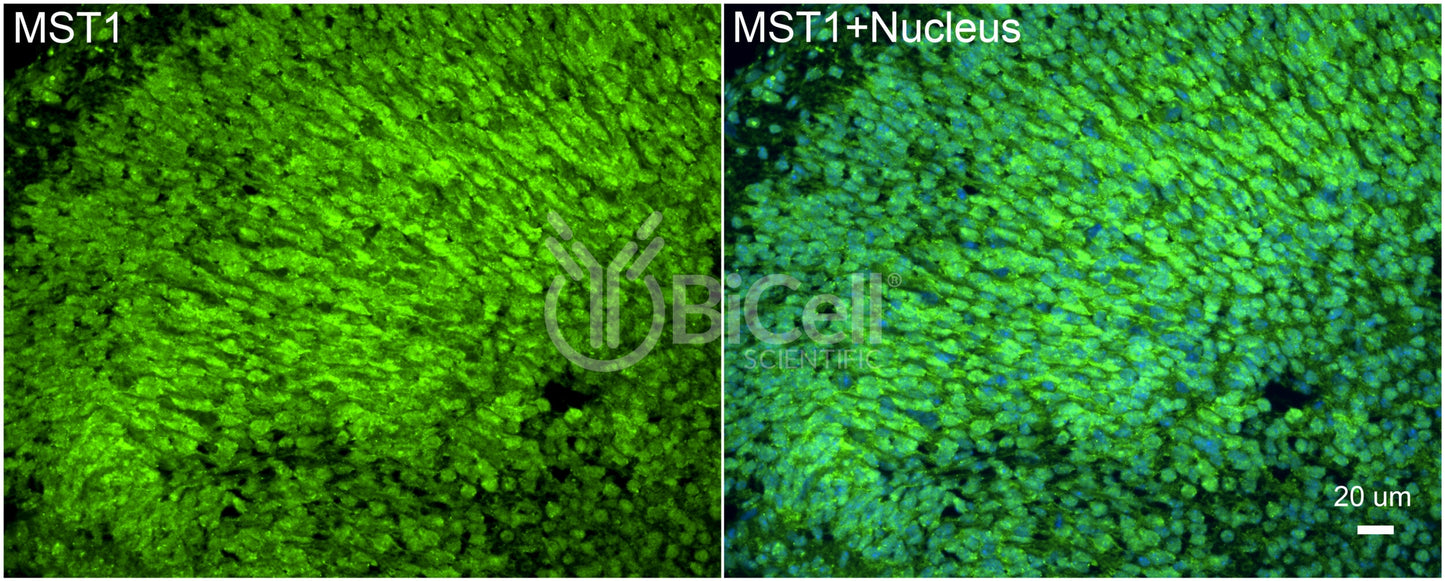 STK4 (MST1) Antibody - FFPE Validated