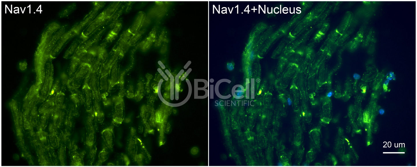 SCN4A (Nav1.4) Antibody