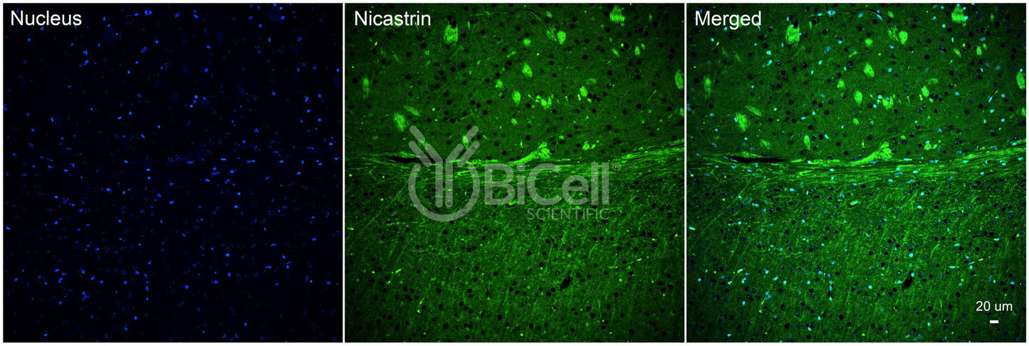 Nicastrin (NCSTN) Antibody - Western Blot Validated