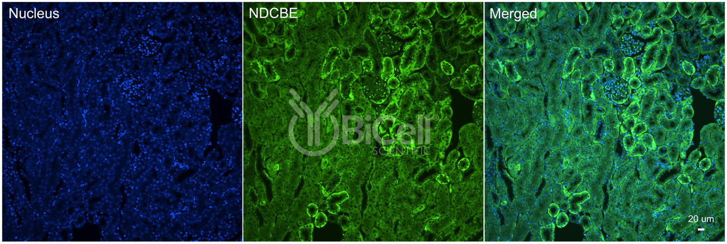 NDCBE (Slc4a8) Antibody - Western Blot Validated