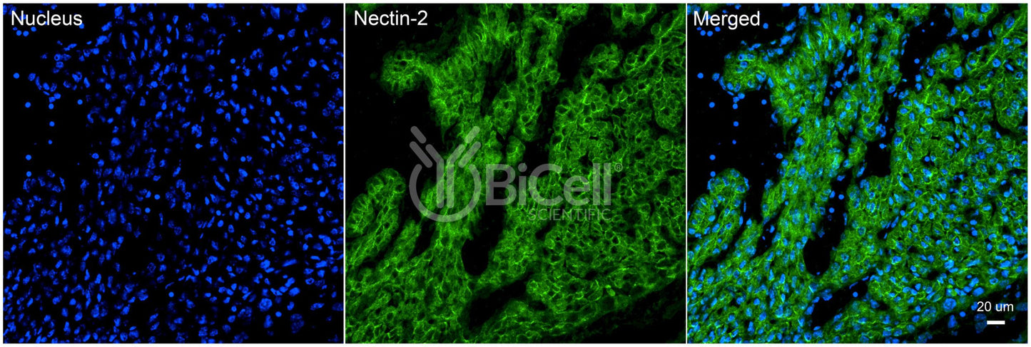 Nectin-2 (HVEB or CD112) Antibody - FFPE Validated