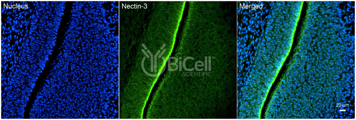 Nectin-3 (CD113) Antibody