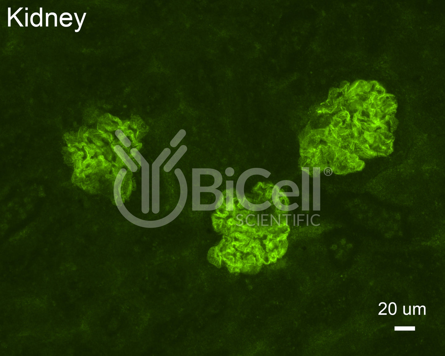 NEPH1 (KIRREL1) Antibody - Western Blot Validated