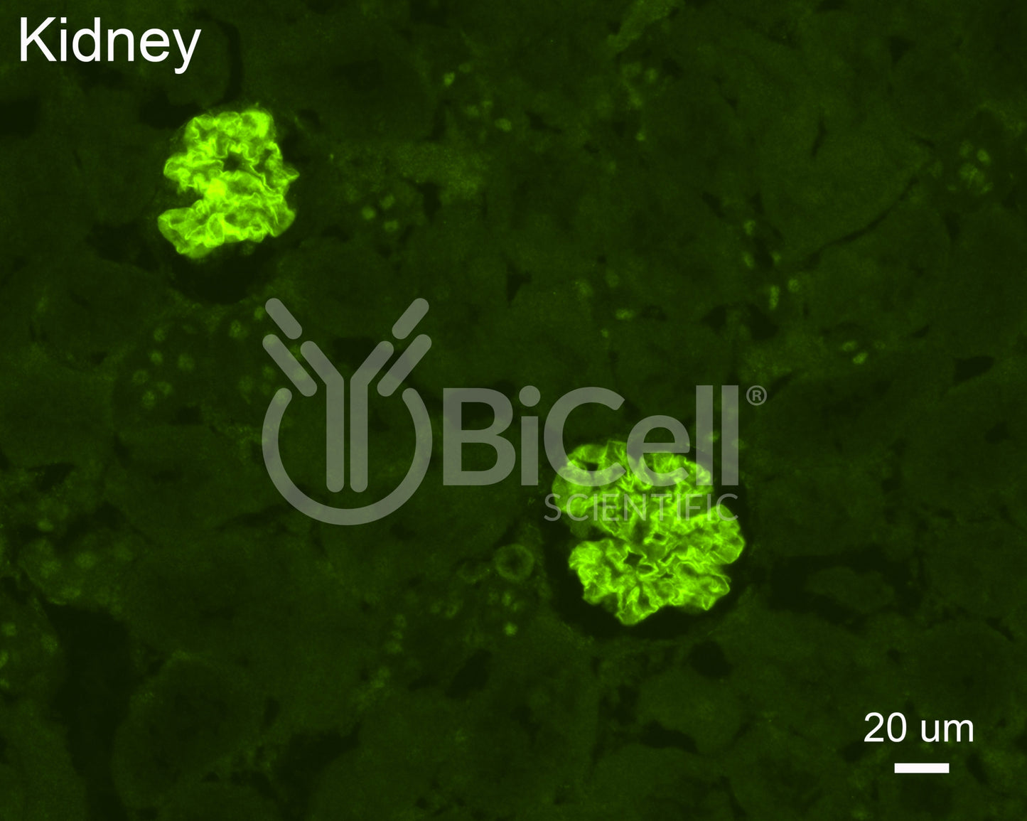 NEPH2 (KIRREL3) Antibody