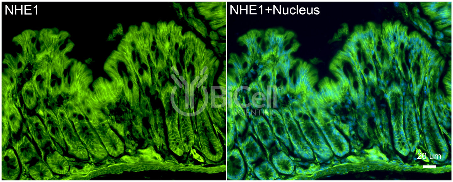 NHE1 (Slc9a1) Antibody