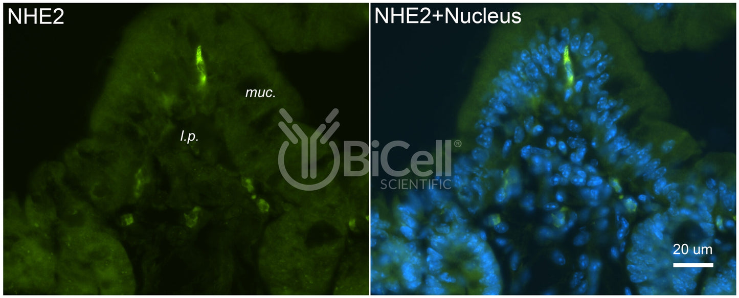 NHE2 (Slc9a2) Antibody