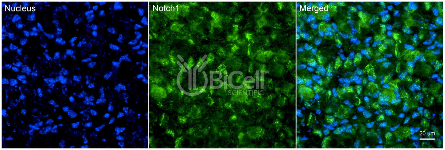 NOTCH1 Antibody - FFPE Validated