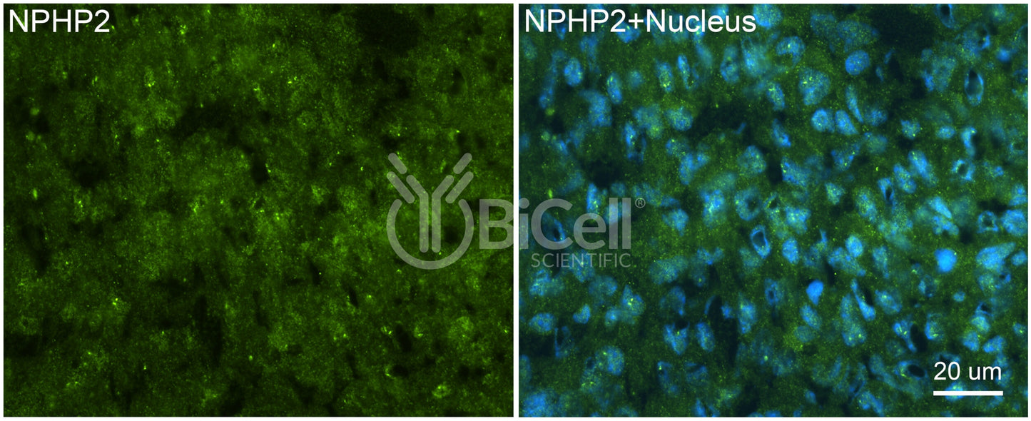 Nephrocystin-2 (NPHP2 or Inversin or INVS) Antibody - FFPE Validated