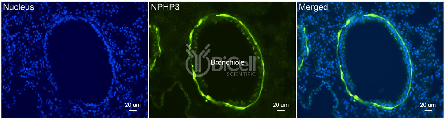 Nephrocystin-3 (NPHP3 or MKS7) Antibody - Western Blot Validated