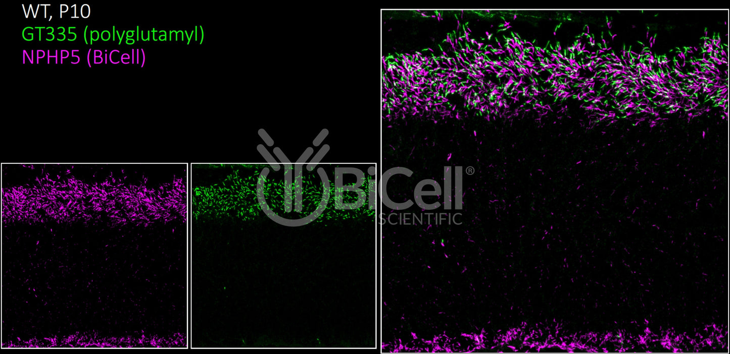 Nephrocystin-5 (NPHP5 or IQCB1) Antibody - FFPE Validated