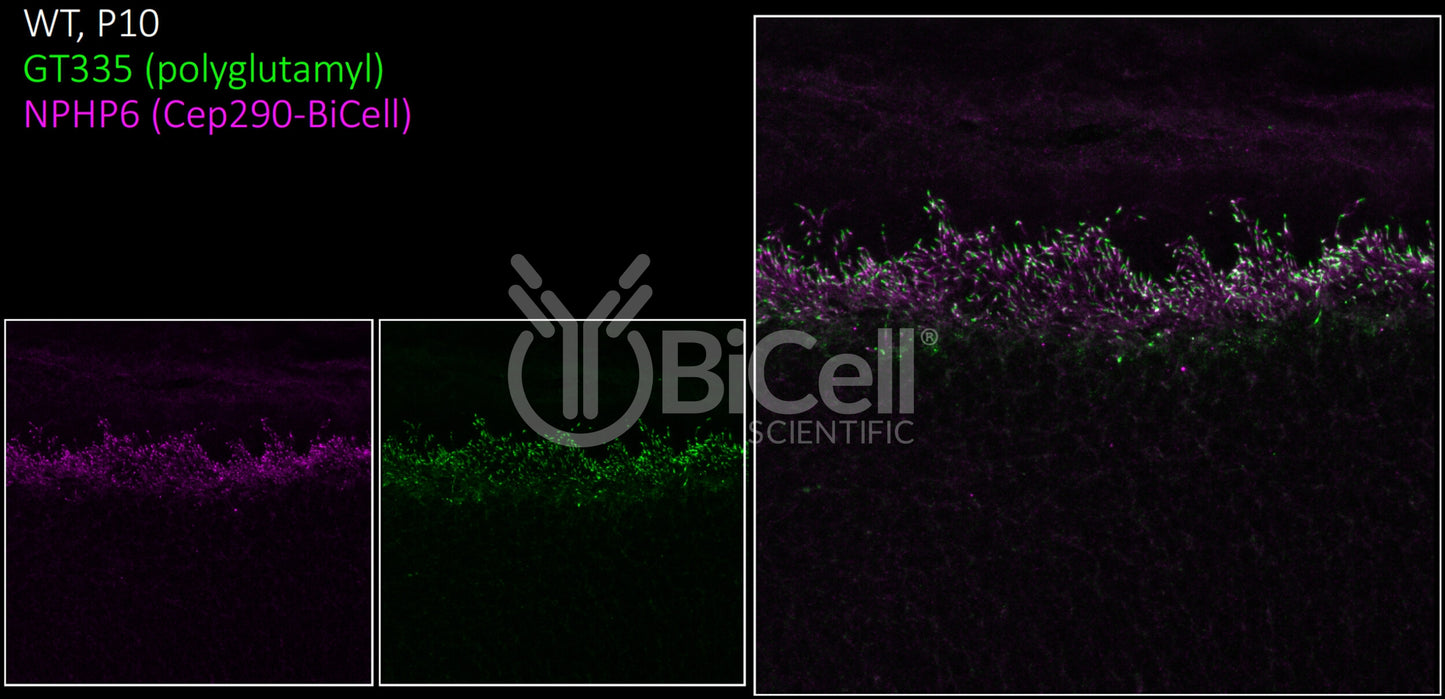 Nephrocystin-6 (NPHP6 or CEP290 or MKS4 or BBS14) Antibody