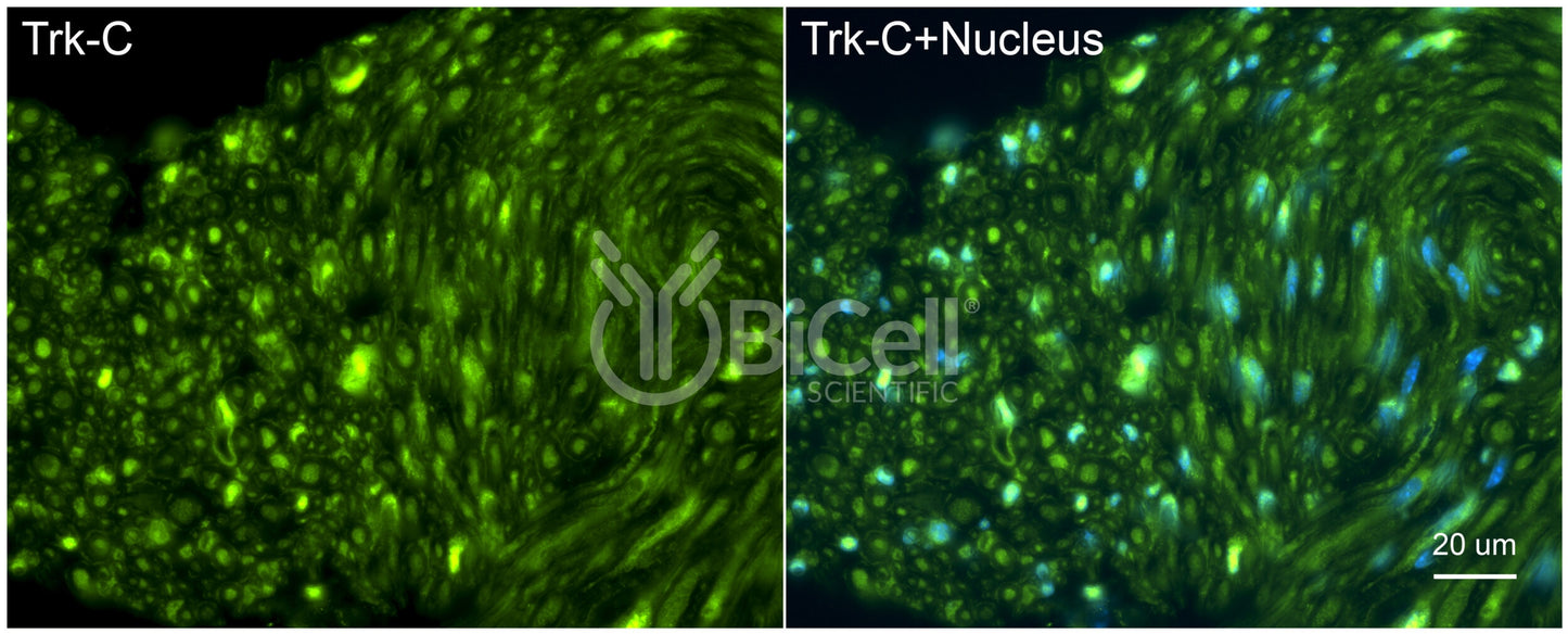 Trk-C (NTRK3) Antibody - Western Blot Validated