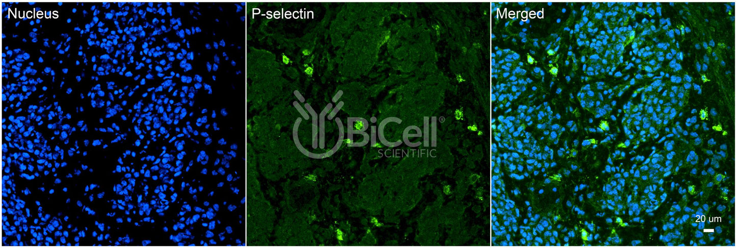 P-selectin (SELP or LECAM3 or CD62P) Antibody - FFPE Validated