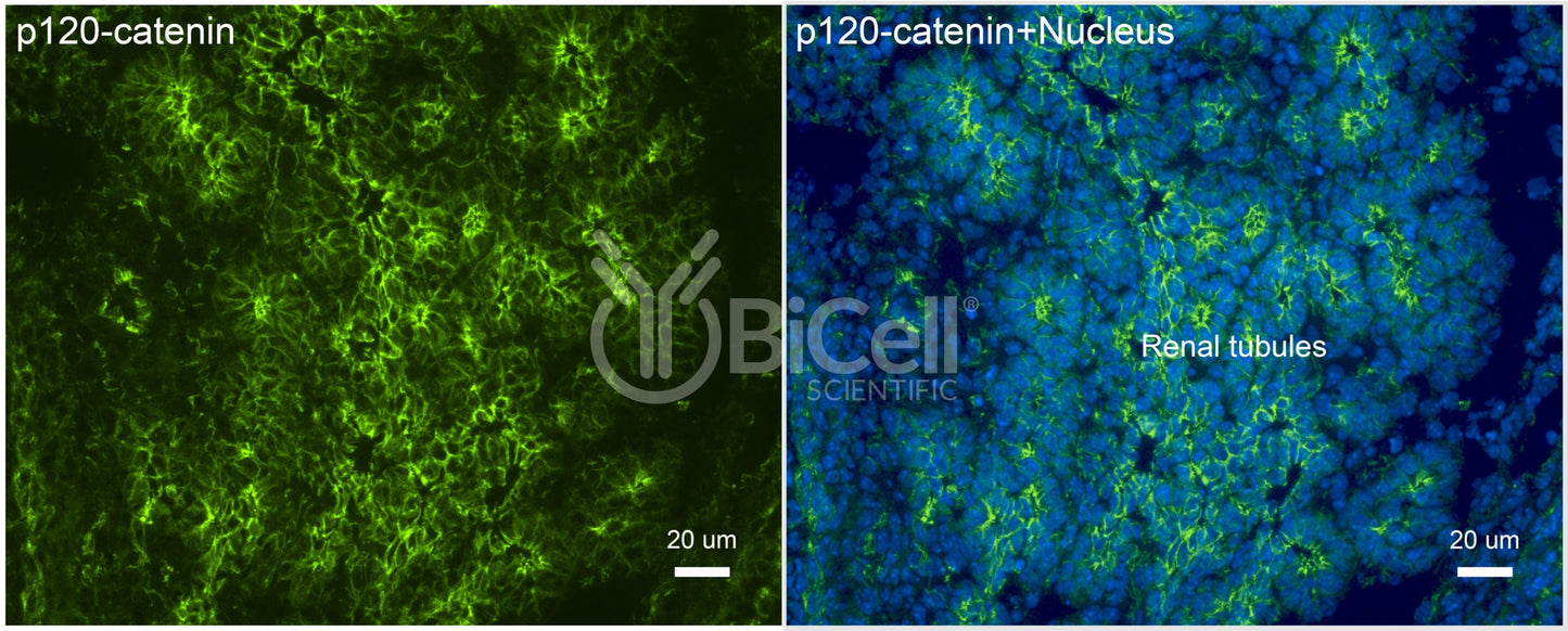 p120-catenin (Ctnnd1) Antibody