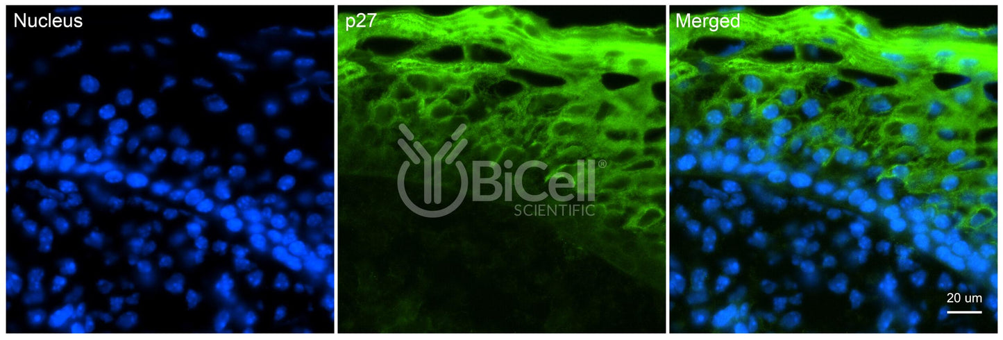 CDKN1B (P27 or P27KIP1 or KIP1) Antibody - FFPE Validated
