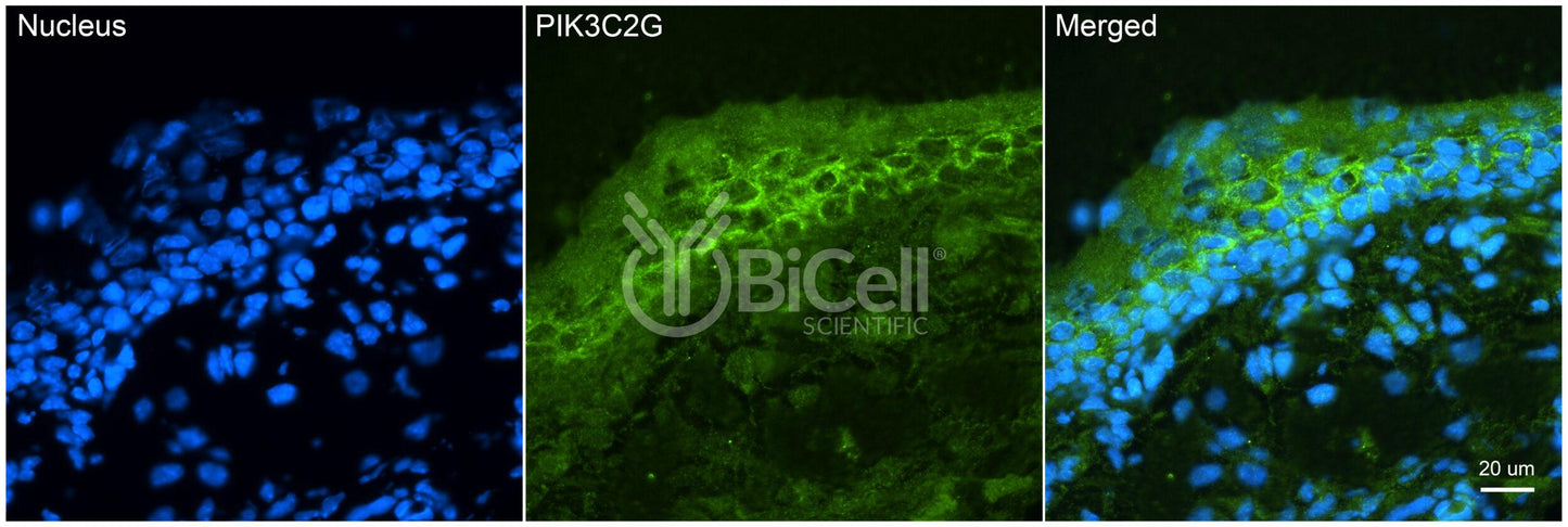 PIK3C2G (PI3K-C2-gamma) Antibody - Western Blot Validated