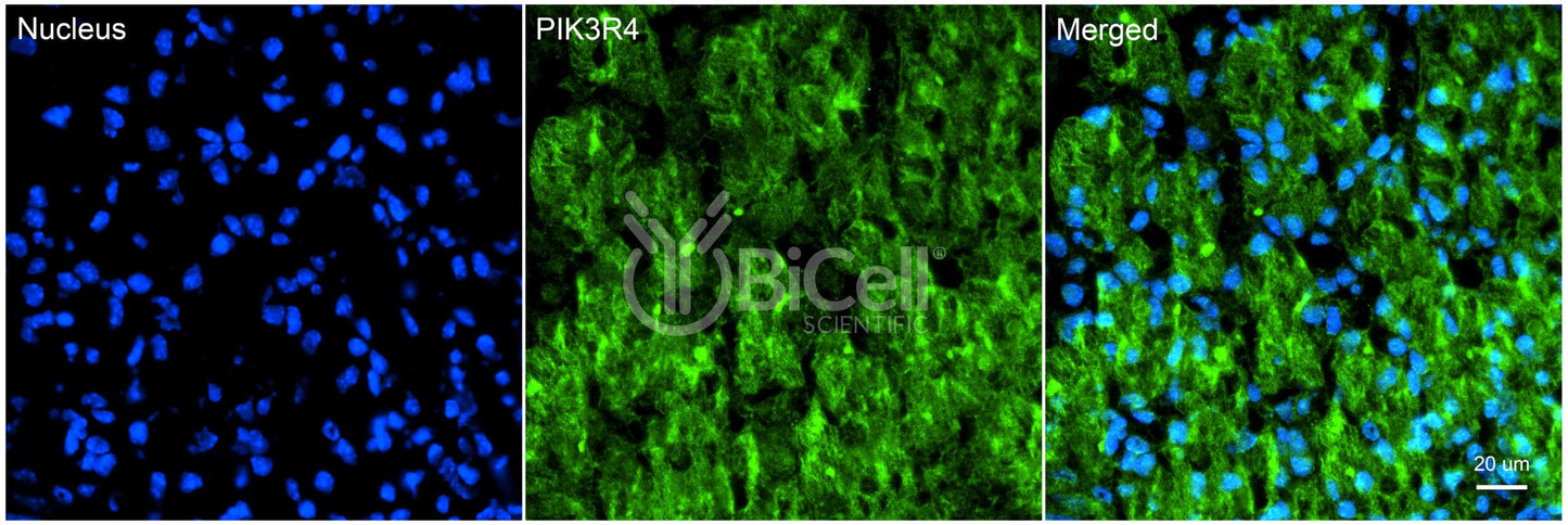PIK3R4 (p150) Antibody