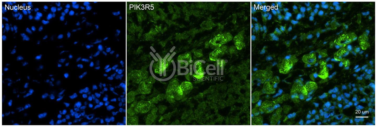PIK3R5 (p101) Antibody