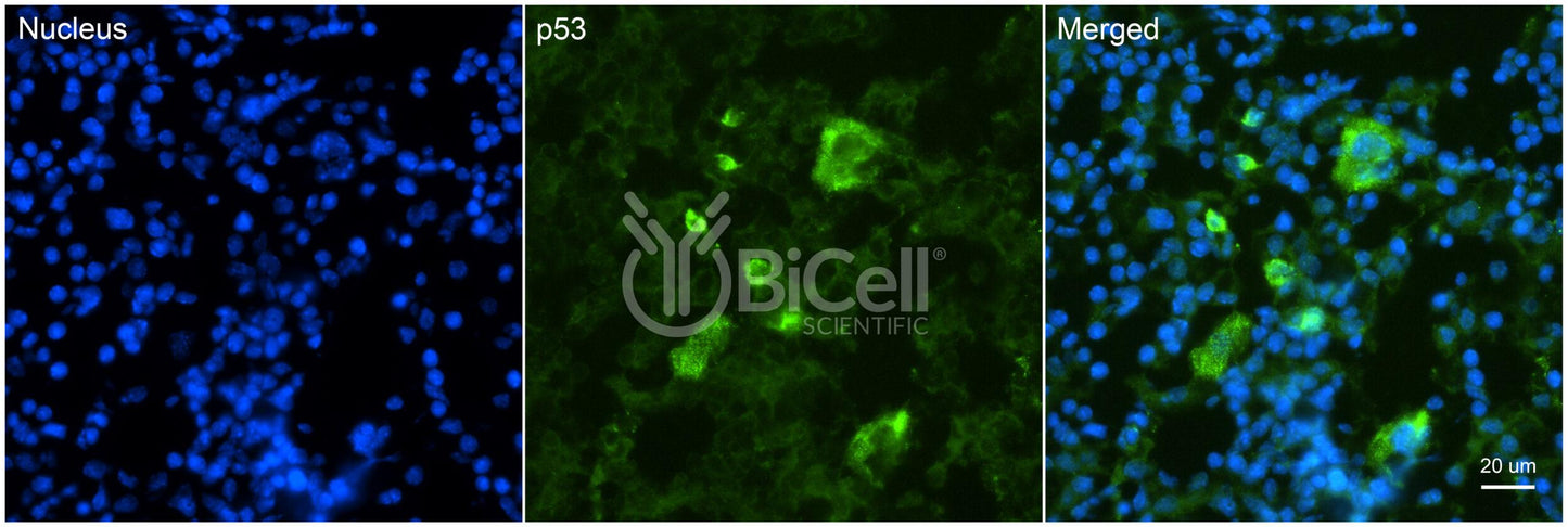 TP53 (P53) Antibody - FFPE Validated
