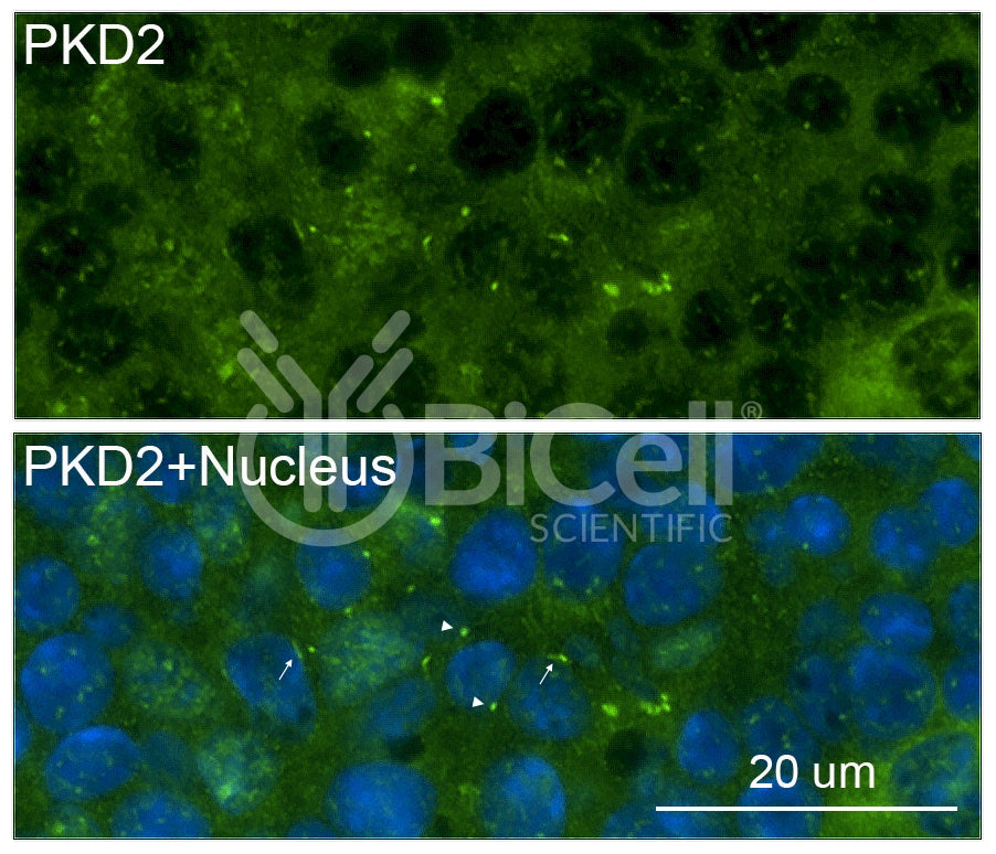 Polycystin-2 (PKD2) Antibody