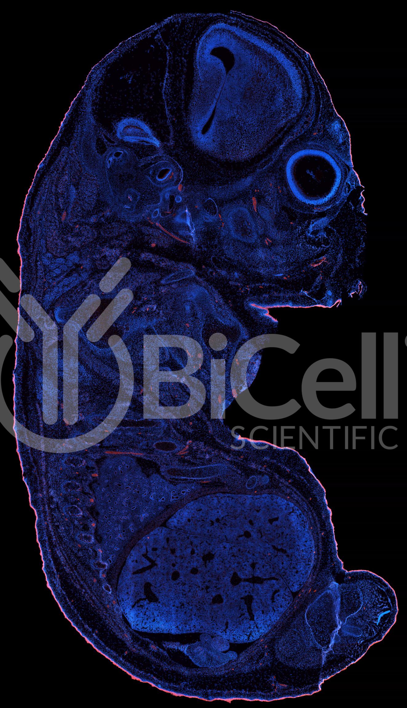 Protocadherin-15 (PCDH15 or CDHR15 or USH1F or DFNB23) Antibody - FFPE Validated