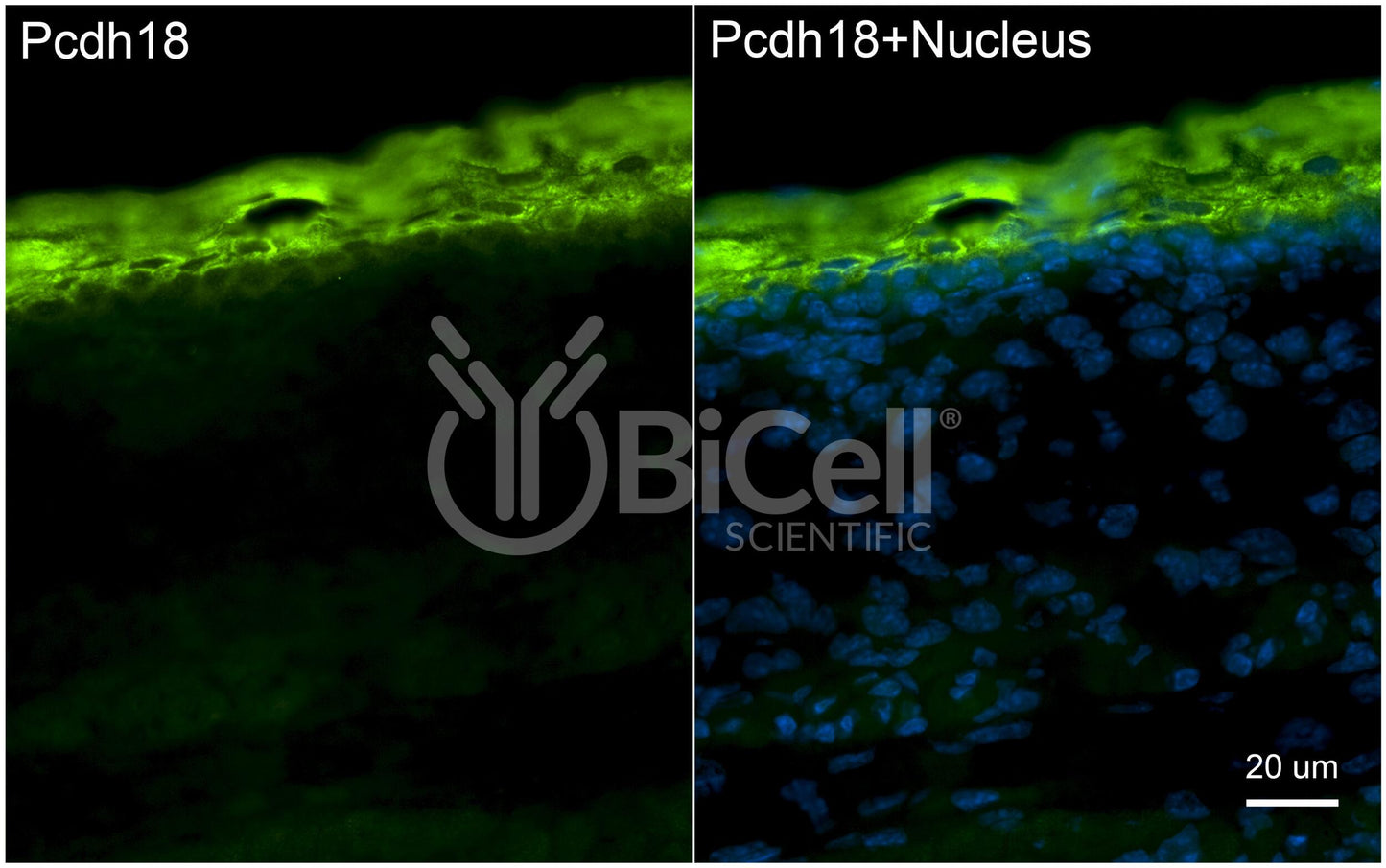 Protocadherin-18 (PCDH18 or PCDH68L) Antibody - FFPE Validated