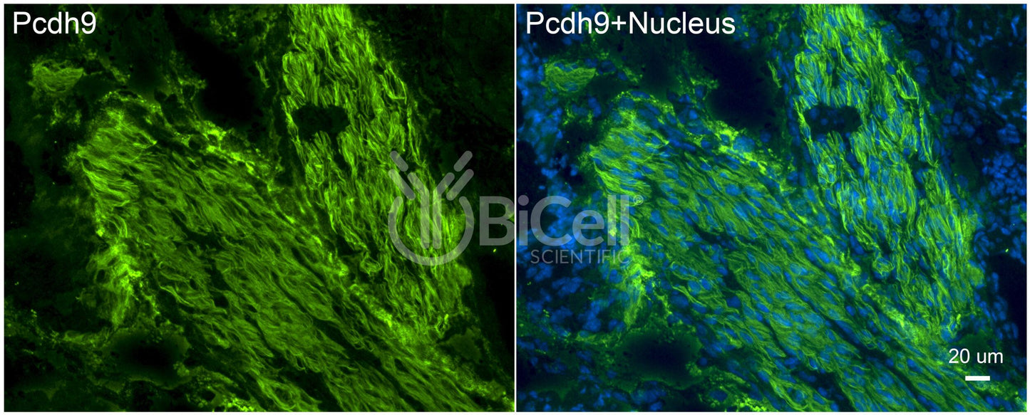 Protocadherin-9 (PCDH9) Antibody - FFPE Validated