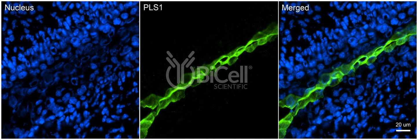 Plastin-1 (PLS1) Antibody - FFPE Validated