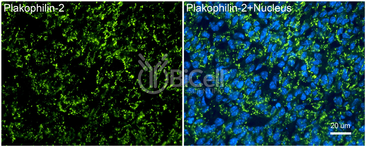 Plakophilin-2 (PKP2) Antibody - Western Blot Validated
