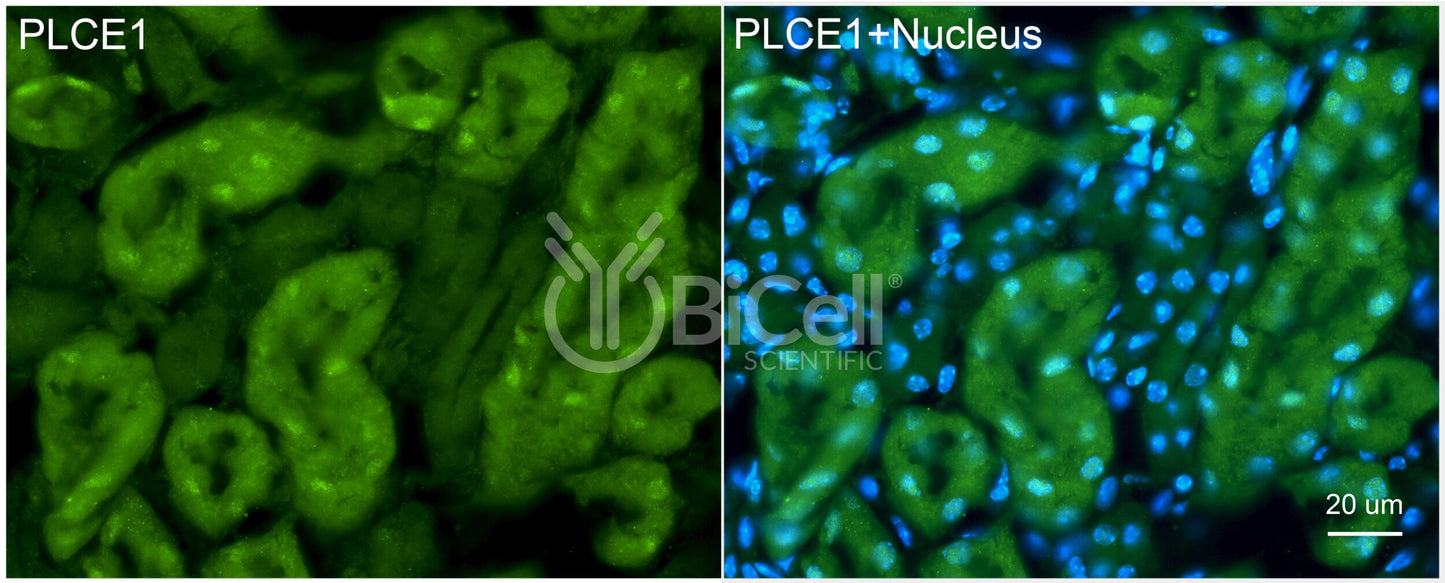 PLCE1 (PLCE) Antibody