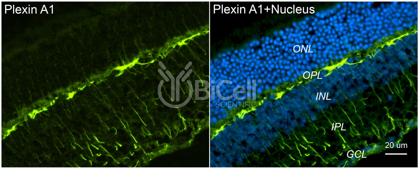 Plexin A1 (PLXNA1) Antibody - Western Blot Validated