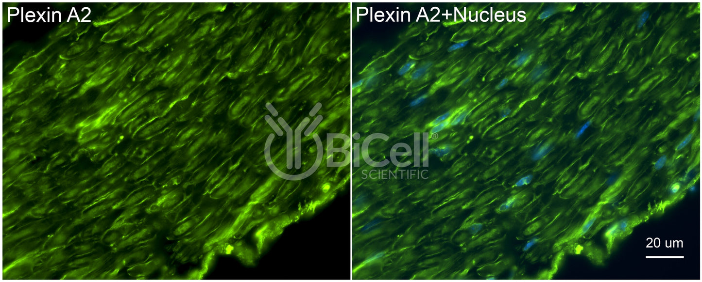 Plexin A2 (PLXNA2) Antibody - FFPE Validated