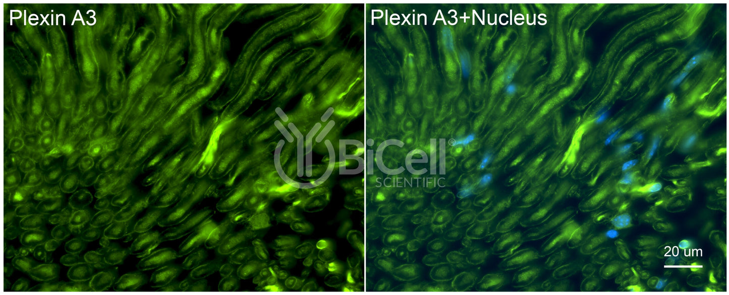 Plexin A3 (PLXNA3) Antibody