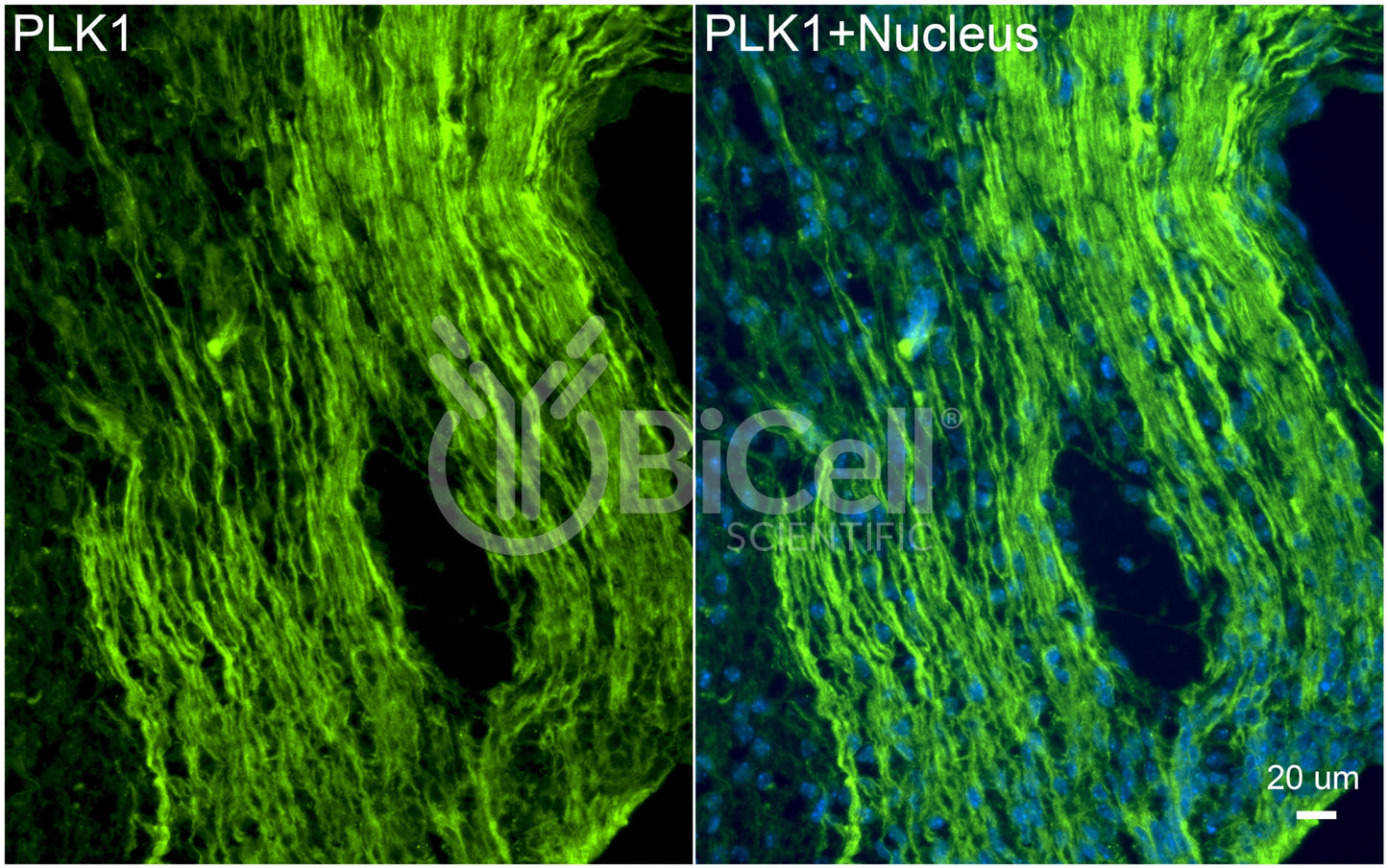 PLK1 (PLK or STPK13) Antibody - FFPE Validated