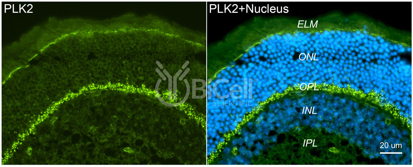 PLK2 (SNK) Antibody