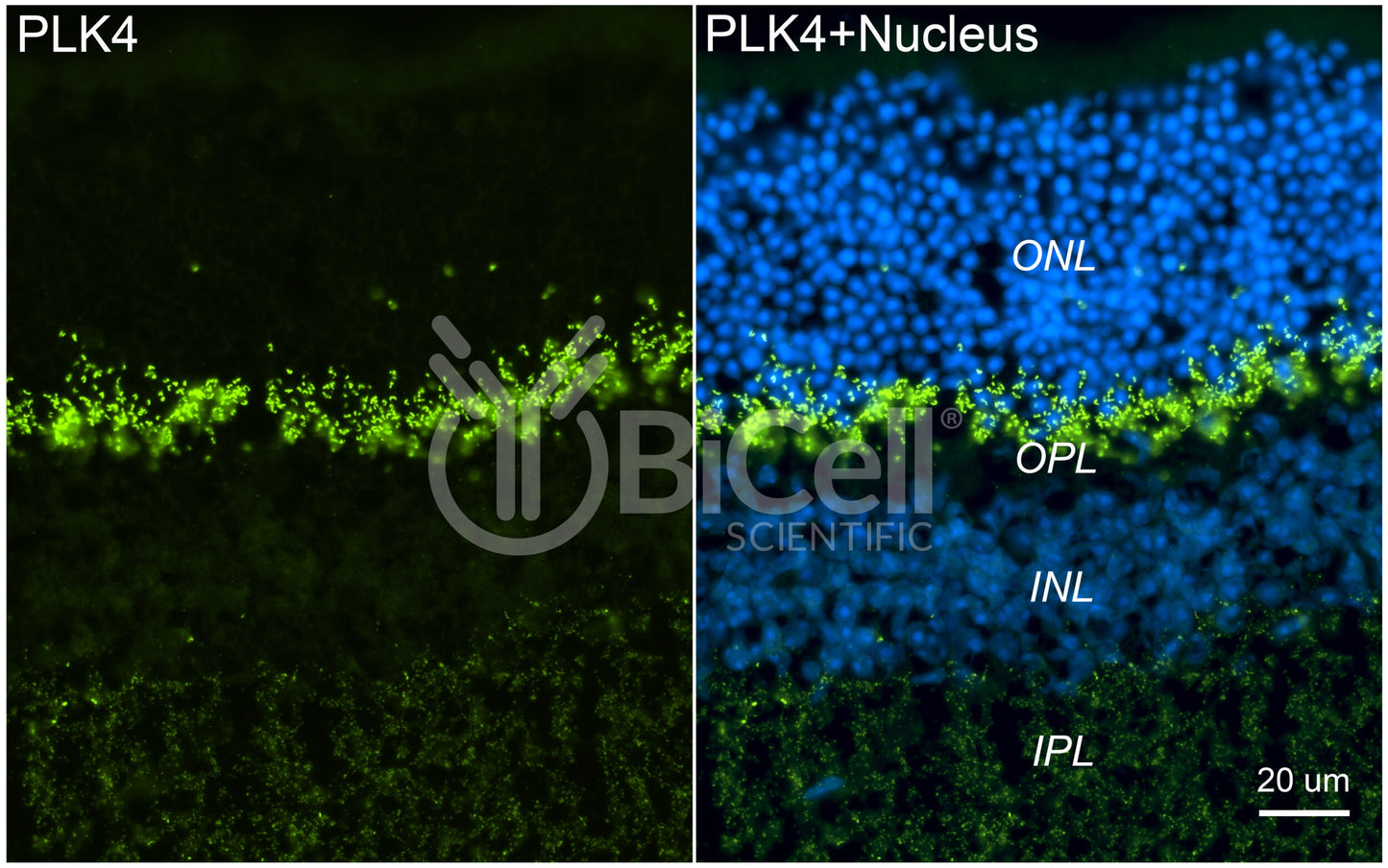 PLK4 (SAK or STK18) Antibody