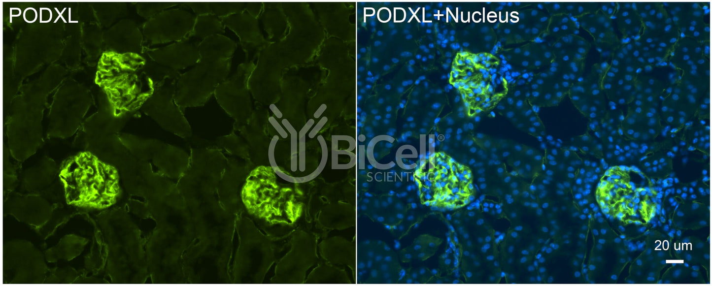 Podocalyxin (PODXL or gp135) Antibody - FFPE Validated