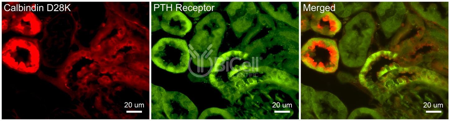 PTH1R Antibody - FFPE Validated