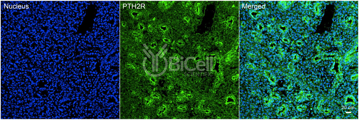 PTH2R Antibody - Western Blot Validated