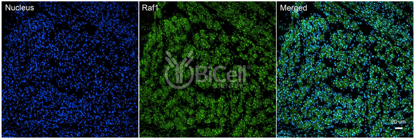 RAF1 (c-Raf or CRAF) Antibody