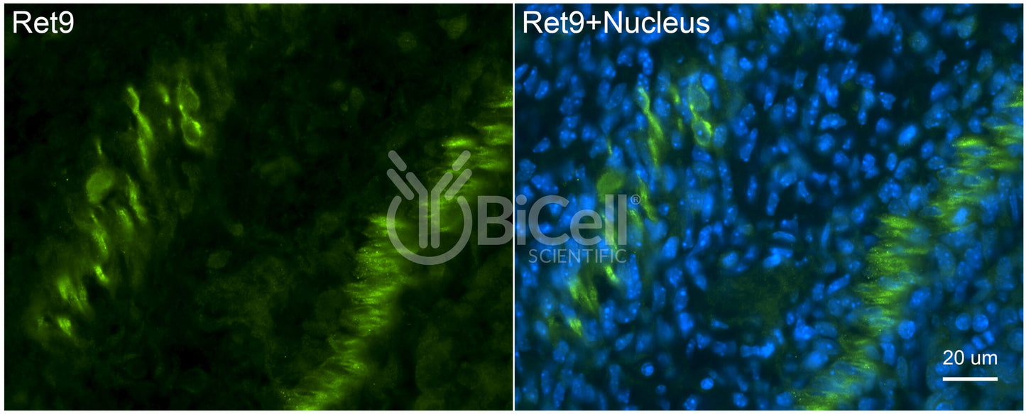 RET9 (RET or CDHF12 or CDHR16) Antibody - FFPE Validated