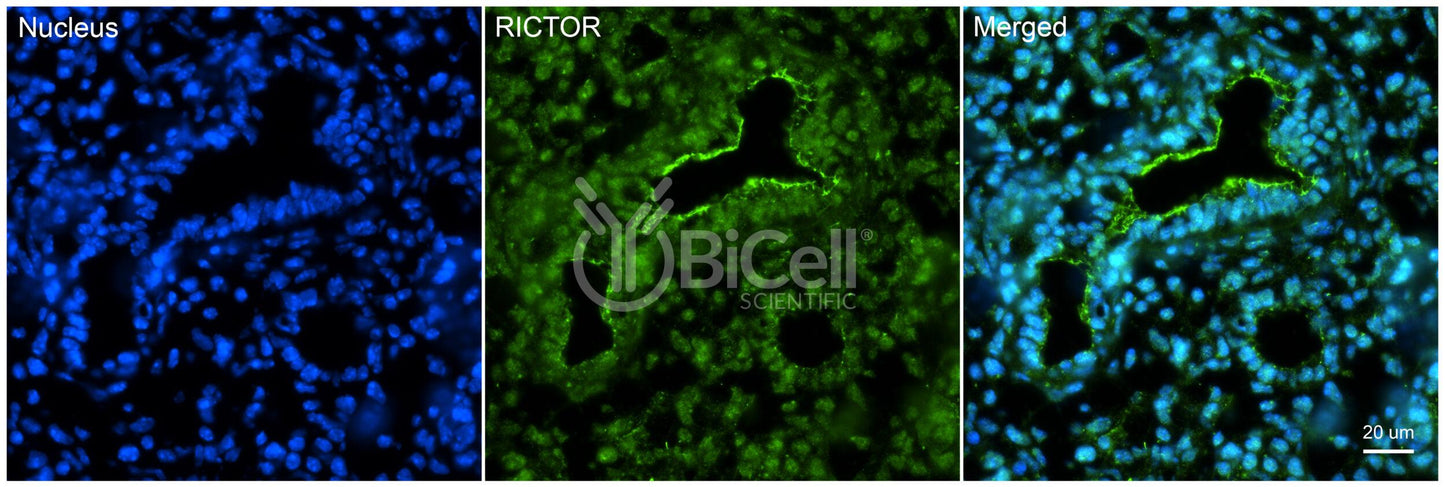 RICTOR Antibody - FFPE Validated