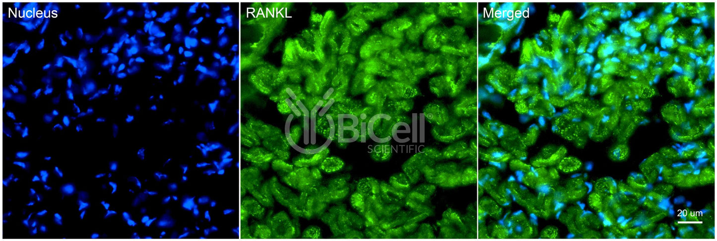 TNFSF11 (RANKL or CD254) Antibody