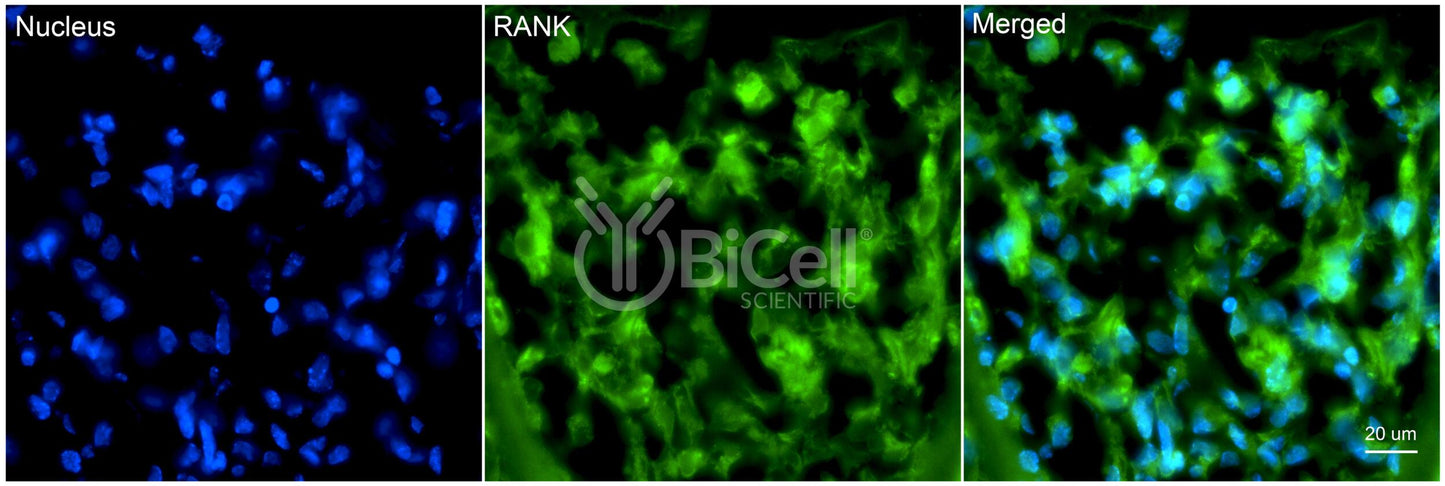 TNFRSF11A (RANK or CD265) Antibody - Western Blot Validated
