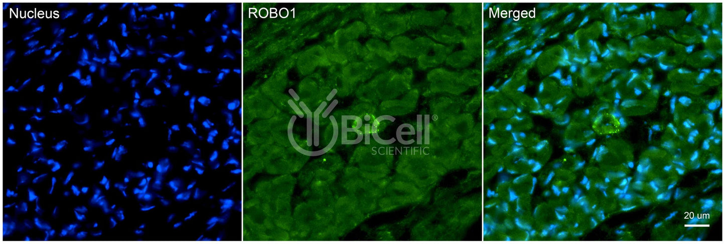 ROBO1 Antibody - Western Blot Validated