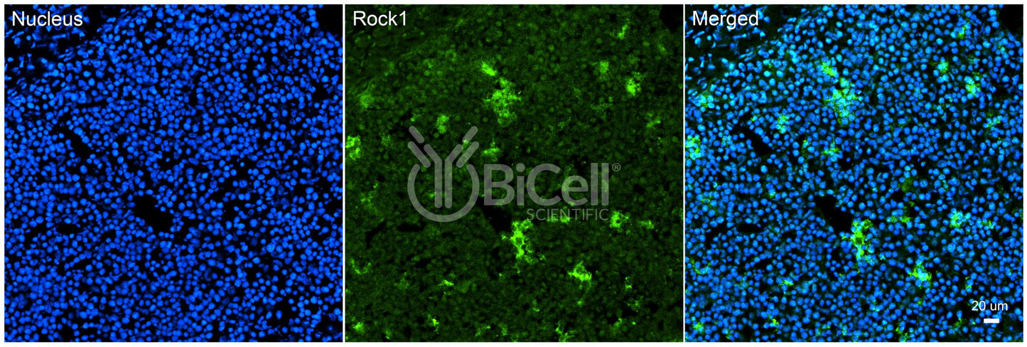 ROCK1 Antibody - Western Blot Validated