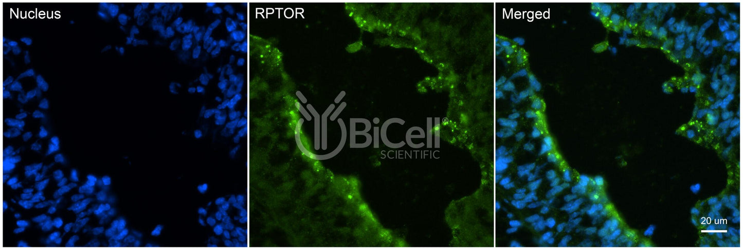RPTOR Antibody