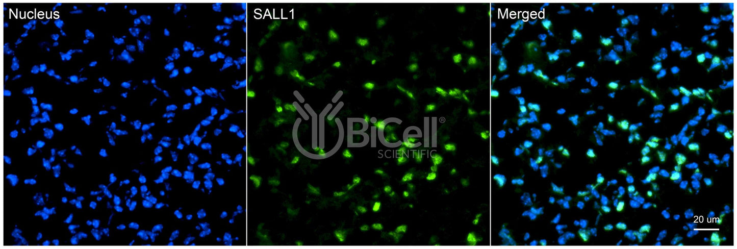 SALL1 Antibody
